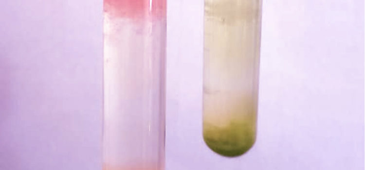 9º ano e a extração do DNA